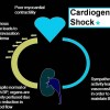 shock cardiogenic