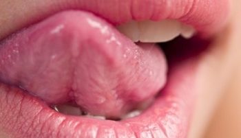 Orthodox treatment for cracking lips