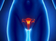 Dysfunctional uterine bleeding reproductive age