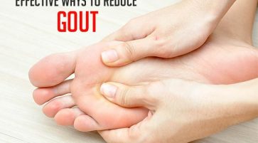 orthodox treatment for gout