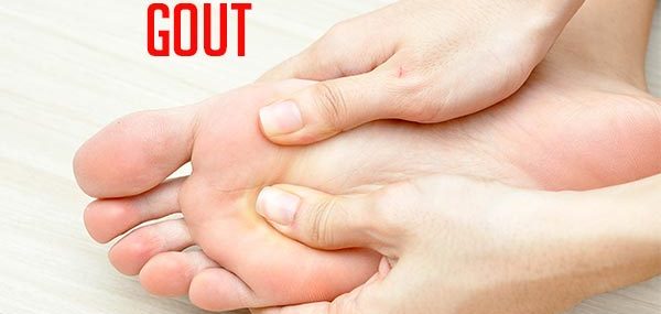 orthodox treatment for gout