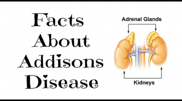 Addisons Disease