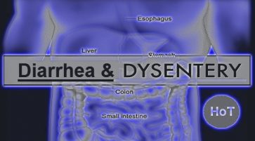 Natural Treatment for diarrhea or dysentery if accompanied with permanent bleeding and mucus