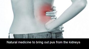 Natural medicine to bring out pus from the kidneys