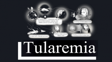 Tularemia Classification Epidemiology Clinic and Treatment