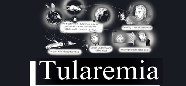 Tularemia Classification Epidemiology Clinic and Treatment