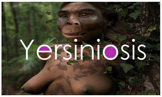 Yersiniosis Epidemiology Clinic and Treatment