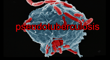 Pseudotuberculosis Epidemiology Clinic and Treatment