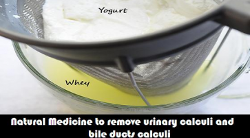Natural Medicine to remove urinary calculi and bile ducts calculi – whey