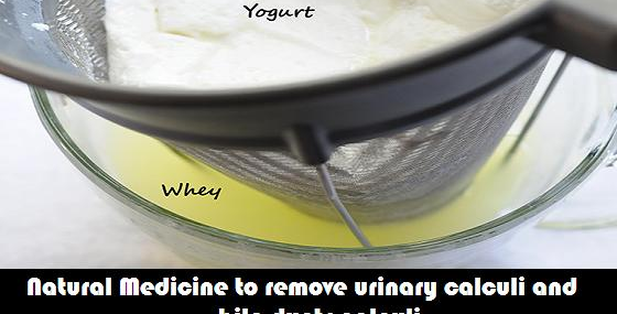 Natural Medicine to remove urinary calculi and bile ducts calculi – whey