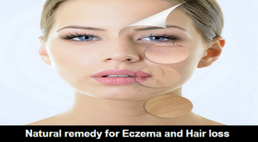 Natural remedy for eczema and hair loss