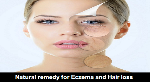 Natural remedy for eczema and hair loss