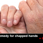 Natural remedy for chapped hands or cracked hands and cracked feet