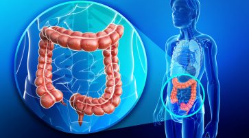 Colorectal cancer Staging Symptoms Diagnosis and Treatment