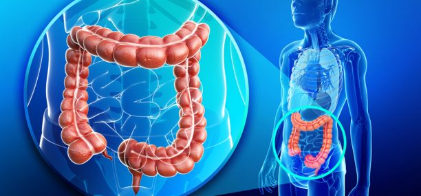 Colorectal cancer Staging Symptoms Diagnosis and Treatment