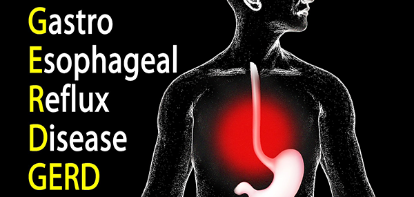What is Gastroesophageal Reflux Disease