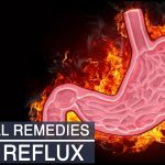 How to cure acid reflux naturally at home