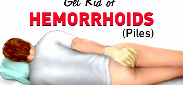 How to cure hemorrhoids at home naturally