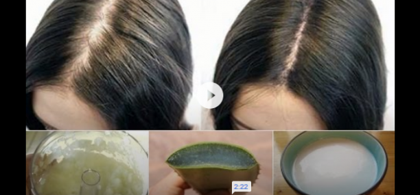 How to prevent hair fall and dandruff