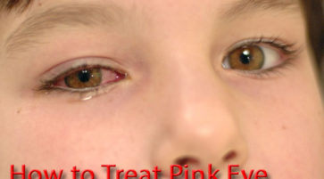 How to cure pink eye at home fast