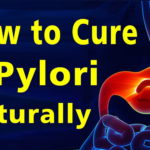 How to get rid of H. pylori infection naturally at home
