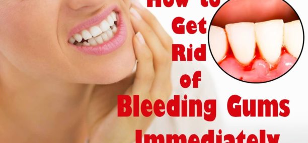 How to stop your gums from bleeding naturally at home