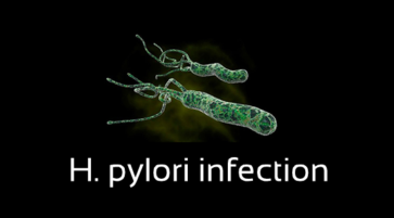 What is H. pylori infection, Epidemiology Symptoms and Treatment